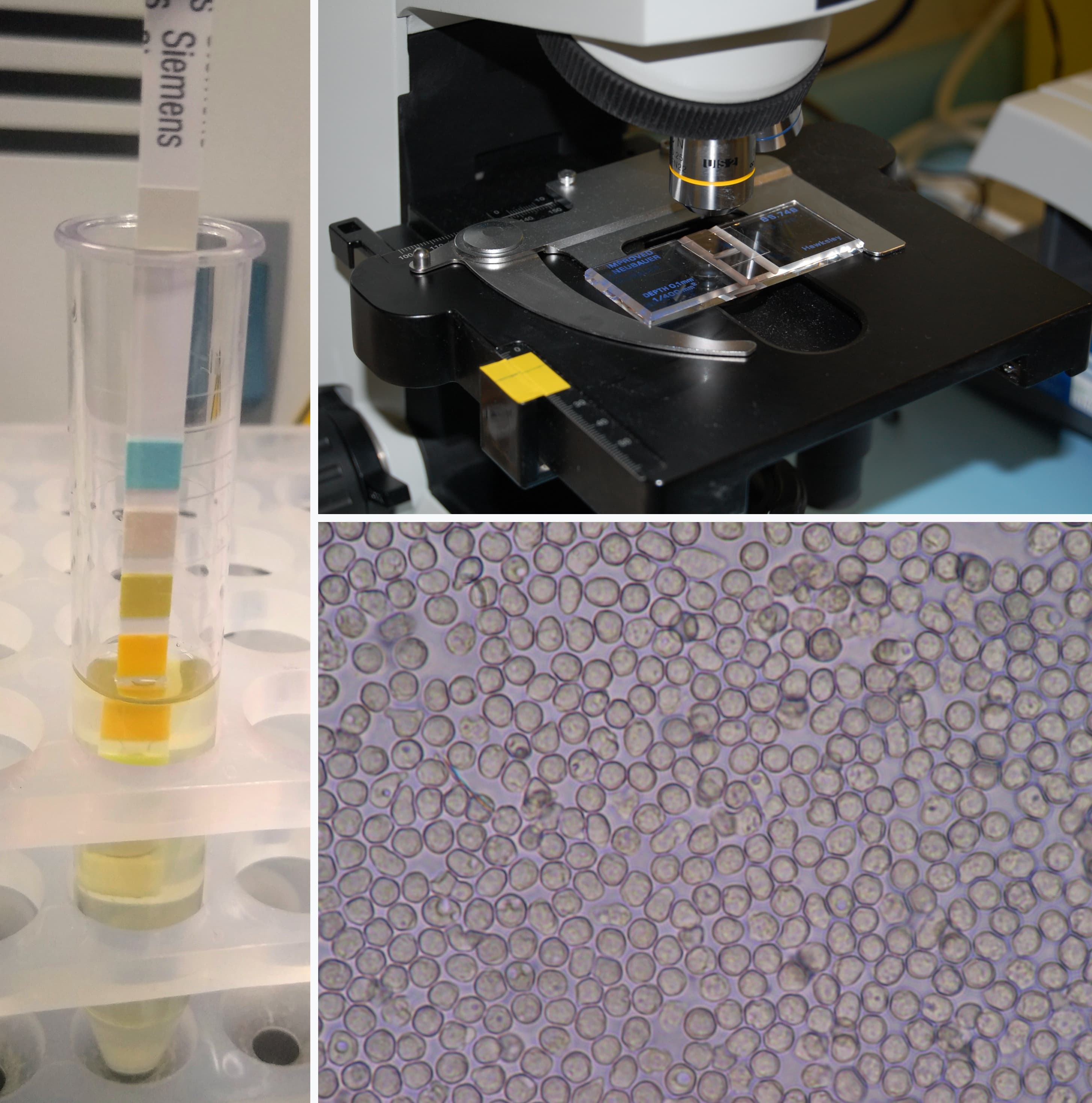 Urinalysis System