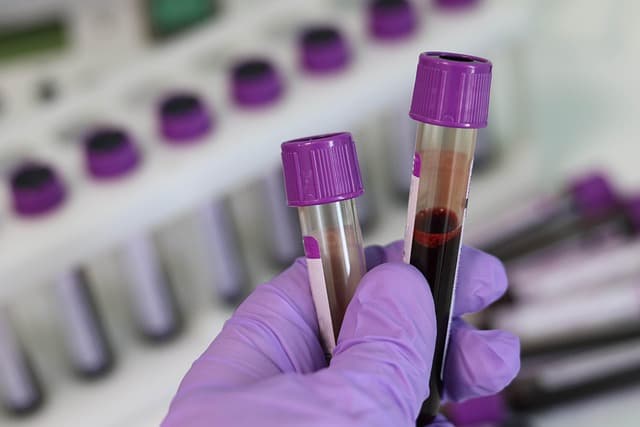 Benefits of home sample collection service from Hi-Tech Medical Laboratory, Swabi