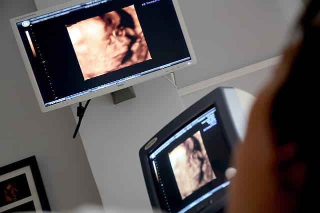 Ultrasound Services
