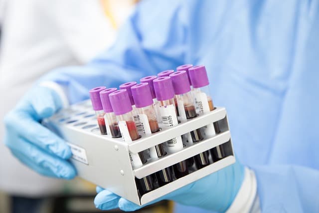 Emergency STAT blood sample testing at Hi-Tech Medical Laboratory, Swabi